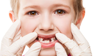دندان های دائمی,دندان شیری کودکان