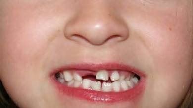 , روشهای مراقبت از دندان شیری کودکان