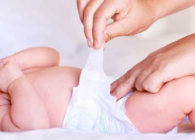 سوختگی پوشک نوزاد,درمان سوختگی پوشک,علت سوختگی پوشک نوزاد