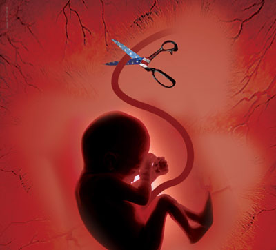 سقط جنین در ماه اول,سقط جنین با قرص
