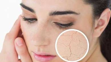 6 مشکل رایج خشکی پوست