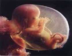 سقط جنین,حکم سقط جنین,احکام سقط جنین